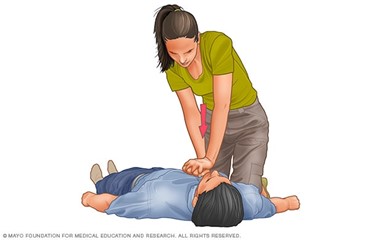 chest compressions