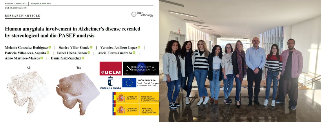 Publicacion del grupo de Neuroplasticida